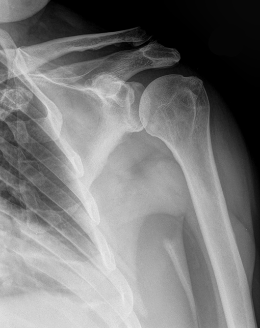 röntgenbild-Dezember-2017---2