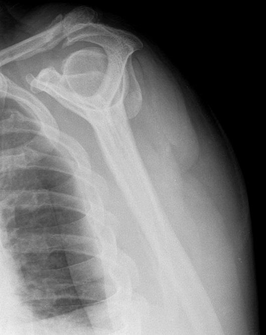 röntgenbild-Dezember-2017